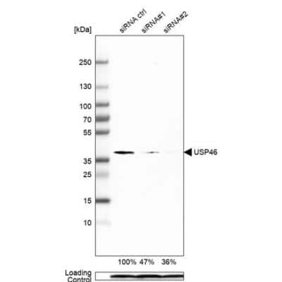 Western Blot: USP46 Antibody (CL0363) [NBP2-52923]