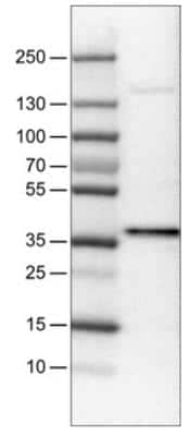 Western Blot: USP46 Antibody (CL0364) [NBP2-30417]