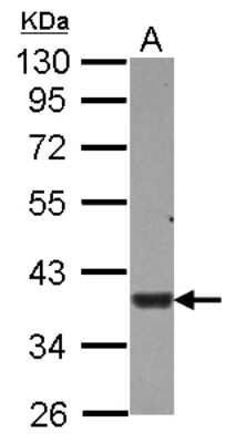 Western Blot: USP46 Antibody [NBP2-20835]