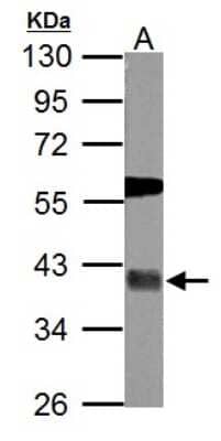 Western Blot: USP46 Antibody [NBP2-20835]