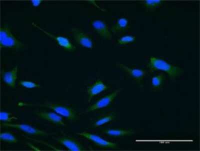 Immunocytochemistry/ Immunofluorescence: USP47 Antibody (1E6) [H00055031-M02]