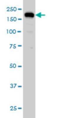 Western Blot: USP47 Antibody (5F9) [H00055031-M01]