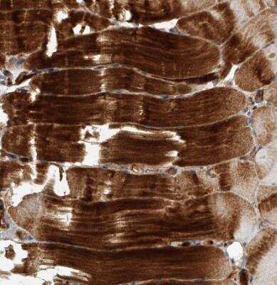 Immunohistochemistry-Paraffin: USP47 Antibody [NBP1-85942]