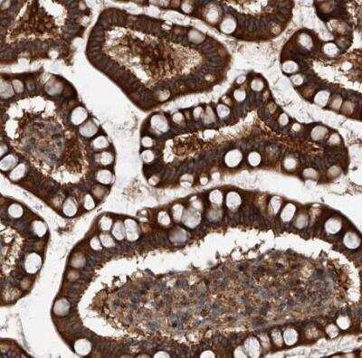 Immunohistochemistry-Paraffin: USP47 Antibody [NBP1-85942]