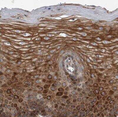 Immunohistochemistry-Paraffin: USP47 Antibody [NBP1-85942]