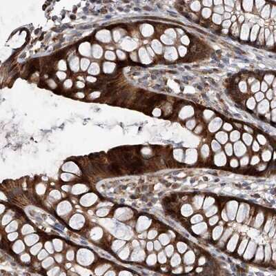 Immunohistochemistry-Paraffin: USP47 Antibody [NBP1-86362]