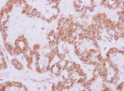 Immunohistochemistry-Paraffin: USP47 Antibody [NBP2-20836]