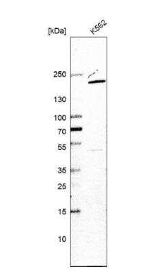 Western Blot: USP47 Antibody [NBP1-85942]