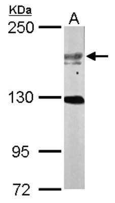 Western Blot: USP47 Antibody [NBP2-20836]