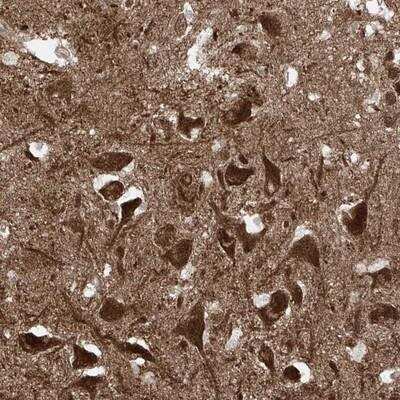 Immunohistochemistry-Paraffin: USP48 Antibody [NBP1-83752]