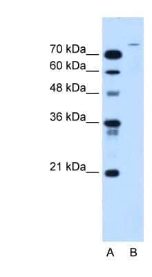 Western Blot: USP48 Antibody [NBP1-59752]