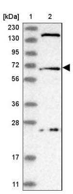 Western Blot: USP49 Antibody [NBP1-81173]