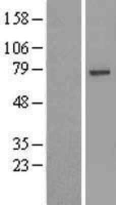 Western Blot: USP49 Overexpression Lysate [NBL1-17668]