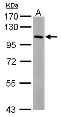 Western Blot: Isopeptidase T/USP5 Antibody [NBP2-20838]