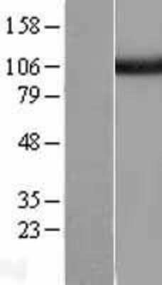 Western Blot: Isopeptidase T/USP5 Overexpression Lysate [NBL1-17669]