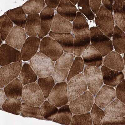 Immunohistochemistry-Paraffin: USP50 Antibody [NBP1-86247]