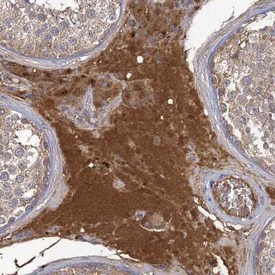 Immunohistochemistry-Paraffin: USP50 Antibody [NBP1-86247]