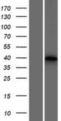 Western Blot: USP50 Overexpression Lysate [NBP2-04545]