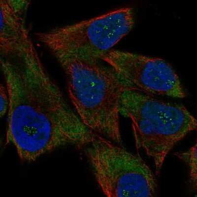 Immunocytochemistry/ Immunofluorescence: USP51 Antibody [NBP1-86167]