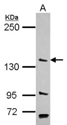 Western Blot: USP52 Antibody [NBP2-15062]