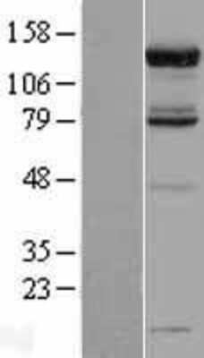 Western Blot: USP52 Overexpression Lysate [NBL1-14090]