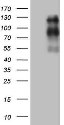 Western Blot: USP53 Antibody (OTI3C9) [NBP2-46307]