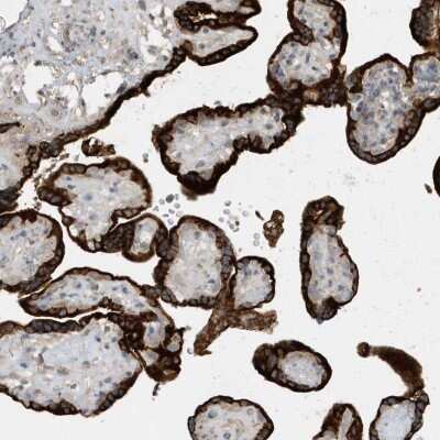 Immunohistochemistry-Paraffin: USP53 Antibody [NBP2-32710]