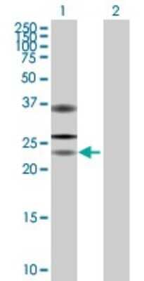 Western Blot: USP53 Antibody [H00054532-B01P]