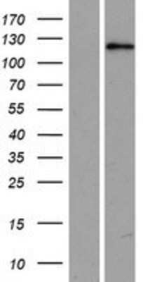 Western Blot: USP53 Overexpression Lysate [NBP2-06730]