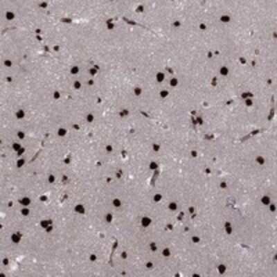 Immunohistochemistry-Paraffin: USP54 Antibody [NBP3-17454]