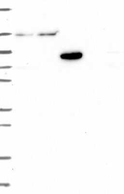 Western Blot: USP54 Antibody [NBP3-17454]