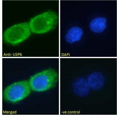 Immunocytochemistry/ Immunofluorescence: USP6 Antibody [NBP2-76350]