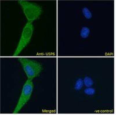 Immunocytochemistry/ Immunofluorescence: USP6 Antibody [NBP2-76350]