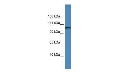 Western Blot: USP6 Antibody [NBP2-86889]