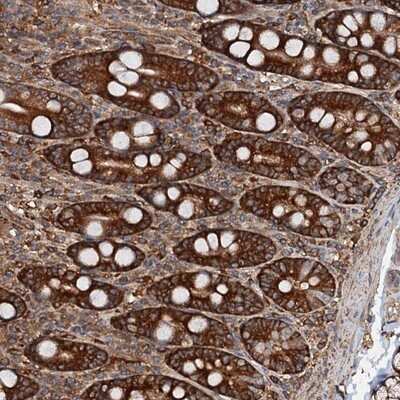 Immunohistochemistry-Paraffin: USP6NL Antibody [NBP1-83061]