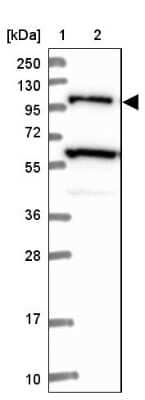 Western Blot: USP6NL Antibody [NBP1-83061]