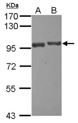 Western Blot: USP6NL Antibody [NBP2-20839]