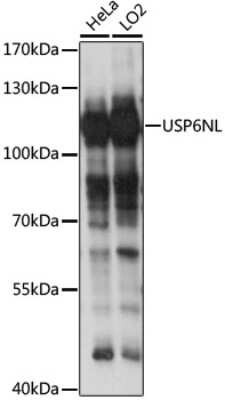 Western Blot: USP6NL AntibodyAzide and BSA Free [NBP2-93558]