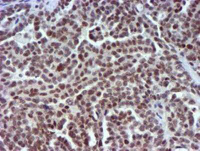 Immunohistochemistry-Paraffin: USP7 Antibody (OTI1F12) [NBP2-01544]