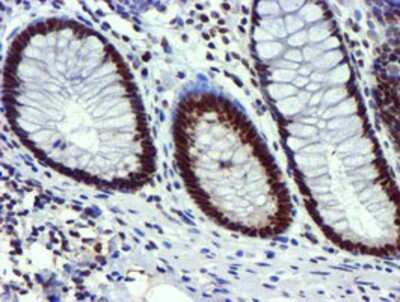 Immunohistochemistry-Paraffin: USP7 Antibody (OTI1F12) [NBP2-01544]