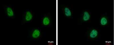 Immunocytochemistry/ Immunofluorescence: USP7 Antibody (6512) [NBP2-43619]
