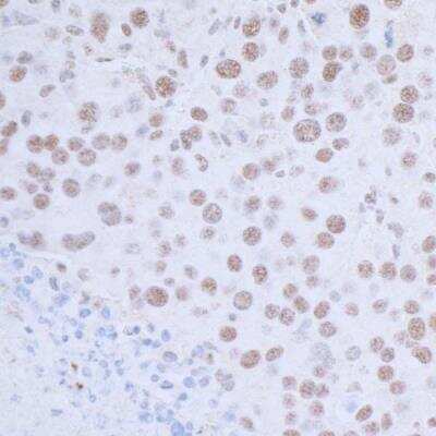 Immunohistochemistry-Paraffin: USP7 Antibody [NB100-513]