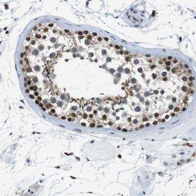 Immunohistochemistry-Paraffin: USP7 Antibody [NBP1-83293]