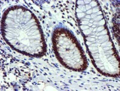 Immunohistochemistry: USP7 Antibody (OTI1F12) - Azide and BSA Free [NBP2-74814]
