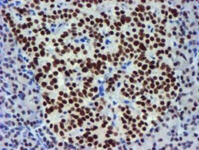 Immunohistochemistry: USP7 Antibody (OTI1F12) - Azide and BSA Free [NBP2-74814]
