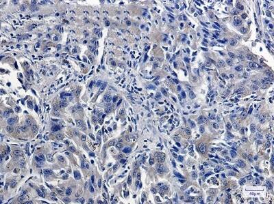 Immunohistochemistry-Paraffin: USP7 Antibody (S02-6B8) [NBP3-19800]