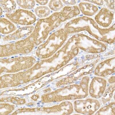 Immunohistochemistry-Paraffin: USP9Y Antibody - Azide and BSA Free [NBP3-16073]