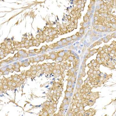 Immunohistochemistry-Paraffin: USP9Y Antibody - Azide and BSA Free [NBP3-16073]