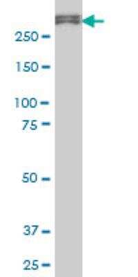 Western Blot: USP9x Antibody (1C4) [H00008239-M01]