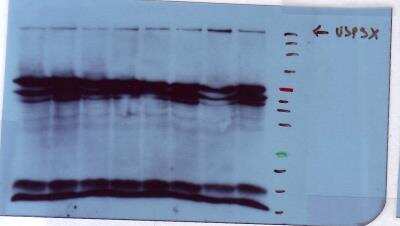 Western Blot: USP9x Antibody (1C4) [H00008239-M01]